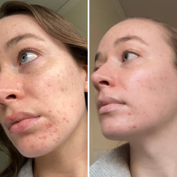 Trudermal LED Light Therapy Face Mask - Image 6