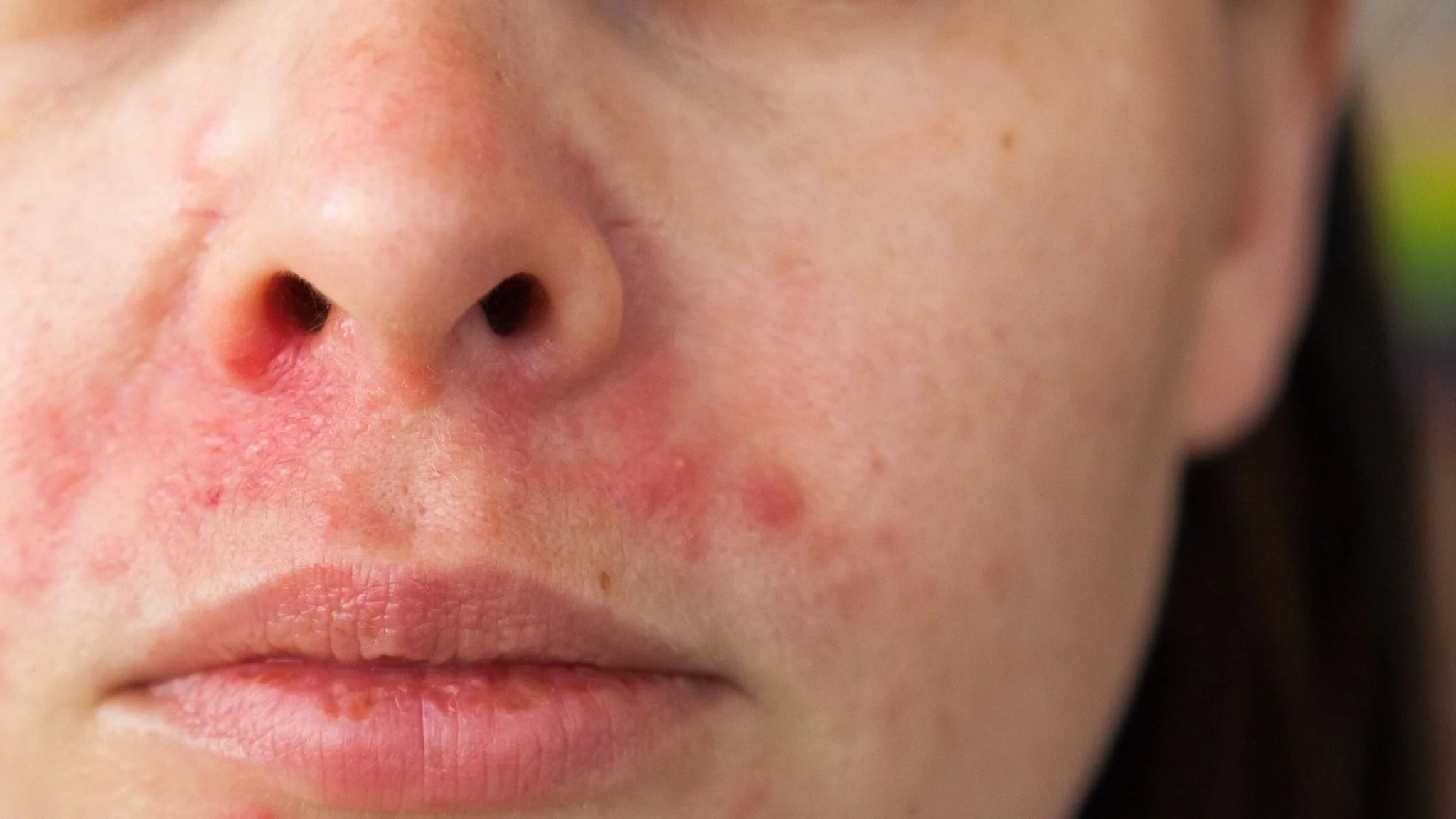 LED Red Light at home Face Masks