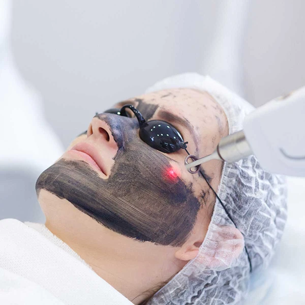 hollywood-carbon-laser-facial