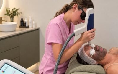 What does a carbon facial do to your face?
