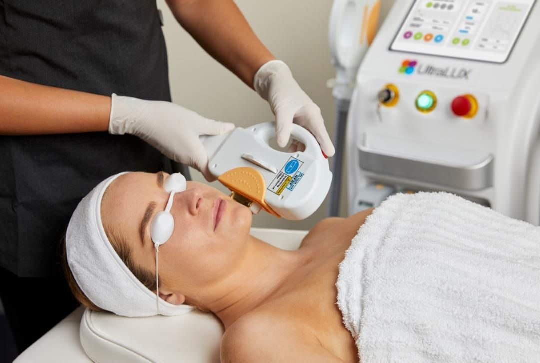 sophie-ipl-hair-removal-2