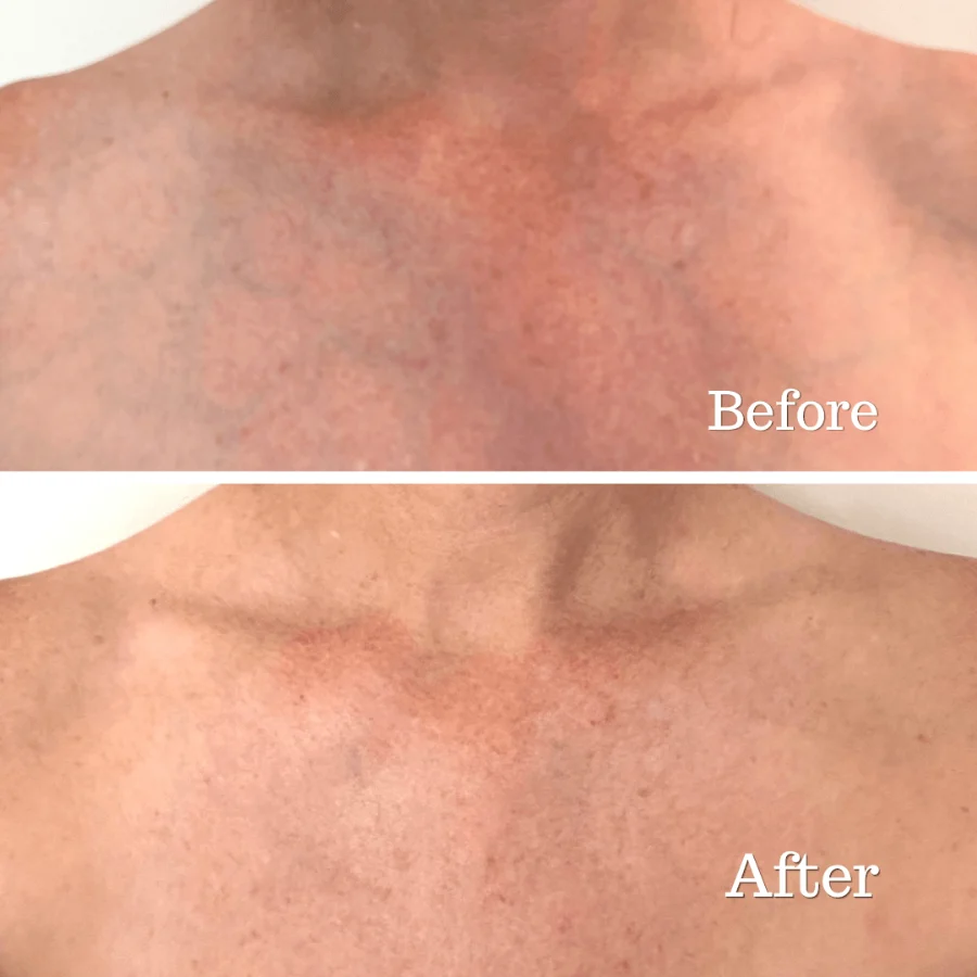 Trudermal Advanced++ LED Neck & Décolletage Mask - Image 3